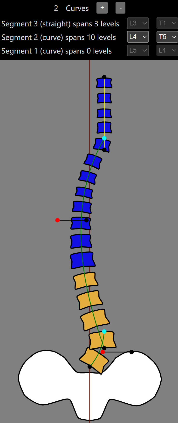 A view of vertebra selectors and a cartoon spine model.